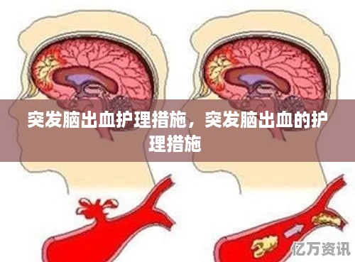 突發(fā)腦出血護理措施，突發(fā)腦出血的護理措施 