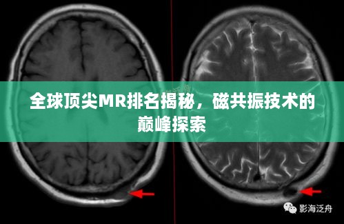 全球頂尖MR排名揭秘，磁共振技術(shù)的巔峰探索