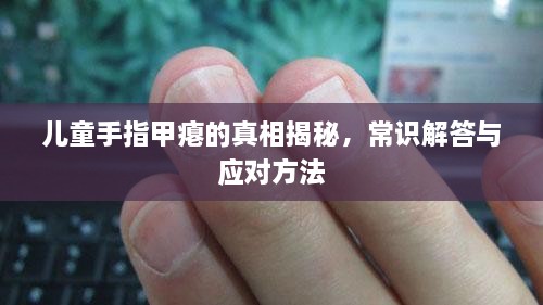 兒童手指甲癟的真相揭秘，常識解答與應(yīng)對方法