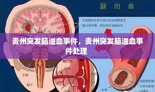 貴州突發(fā)腦溢血事件，貴州突發(fā)腦溢血事件處理 